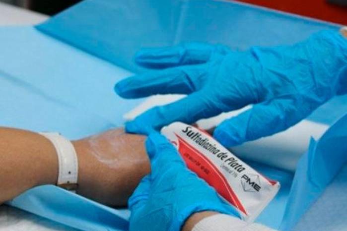 Urgencias registran hasta 20% más casos de quemaduras infantiles en Navidad.