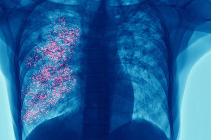 El diagnóstico incluye exámenes físicos, pruebas de laboratorio, estudios por imágenes y tamizaje.