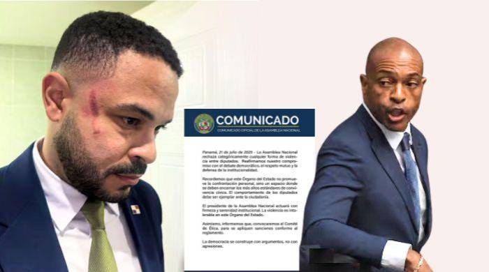 Betserai Richards quedó con un visible moretón en la parte derecha del rostro. Salazar es el señalado.