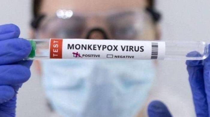 Según la Organización Panamericana de la Salud, la enfermedad es una zoonosis causada por el virus de la viruela del mono.