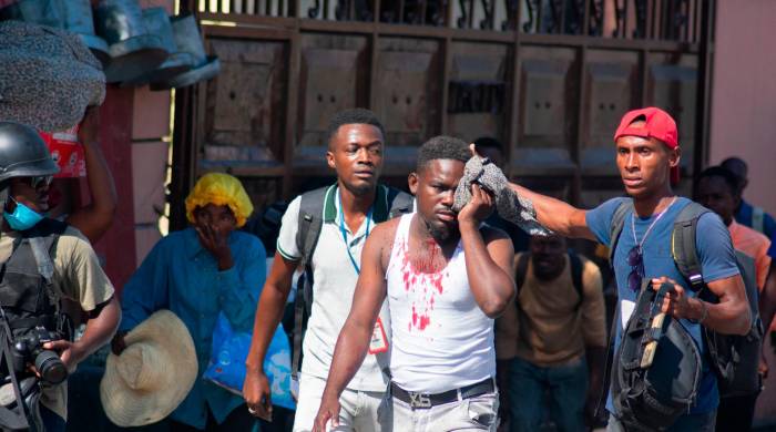 Un periodista herido recibe ayuda tras ser alcanzado por un bote de gas lacrimógeno disparado por la policía en Puerto Príncipe, Haití.