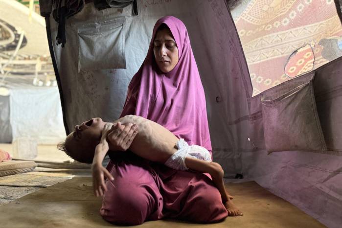 El pequeño gazatí Mohamed Motawaq, de tan solo 18 meses, de cuerpo esquelético pasa los días en Gaza en brazos de su madre, Hidaya al Mutauaq, un mujer viuda, de 30 años.
