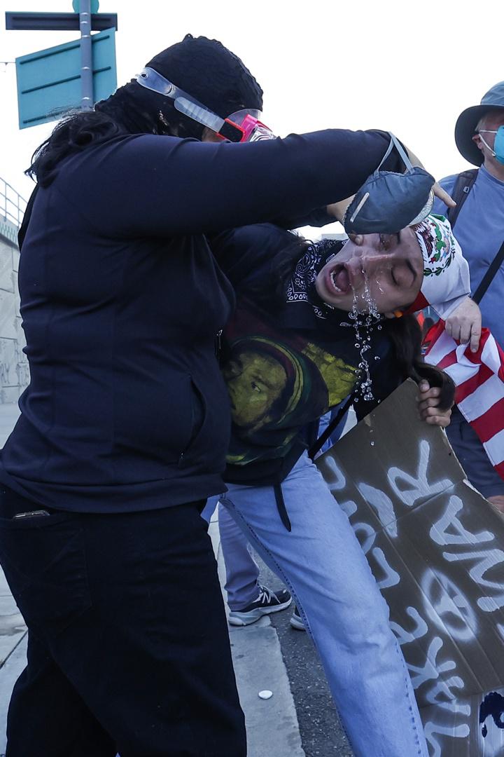 Activistas reciben atención médica tras ser atacados con gas lacrimógeno durante una protesta frente al Centro de Detención Metropolitano, en el marco de la manifestación “No Kings” en el centro de Los Ángeles, California, EE.UU.