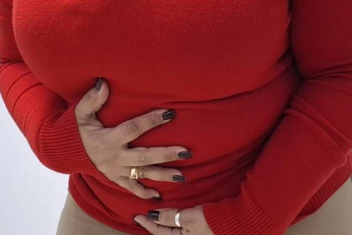 Minsa explica qué es el norovirus y cómo evitar el contagio