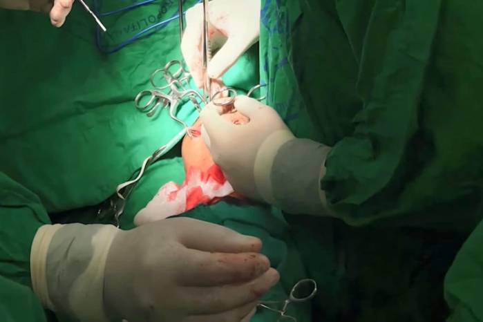 Minsa y CSS activan convocatoria y fijan condiciones para médicos extranjeros