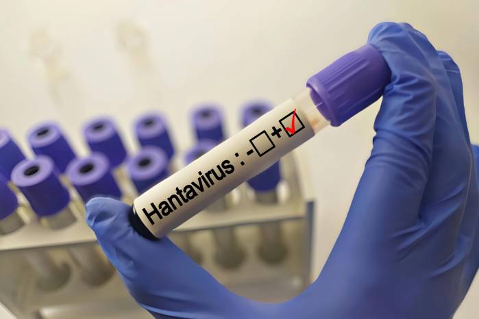 El hantavirus es una enfermedad zoonótica transmitida por la inhalación de secreciones de roedores infectados.