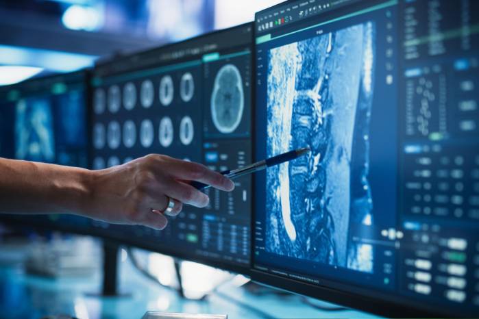 El cáncer es ya la primera causa de muerte en el mundo y podría alcanzar 30,5 millones de nuevos casos en 2050, según The Lancet.